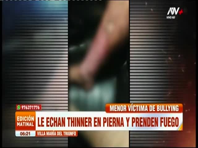 Le echan thiner y la prenden fuego