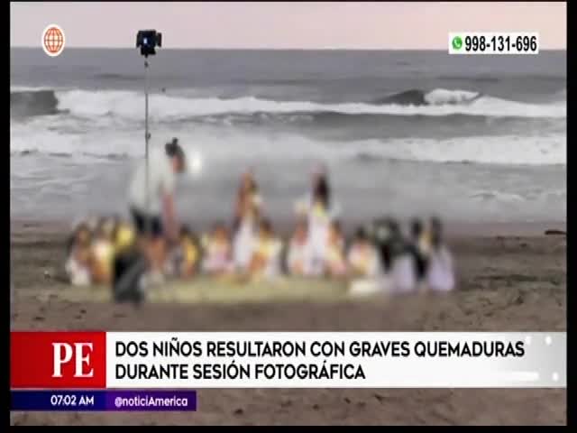 Niños con quemaduras graves tras sesión fotográfica